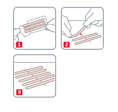 LEUKOPLAST Wound Closure Strip Sterile-Natural